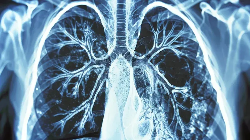 Lung cancer: The most preventable deadly cancer