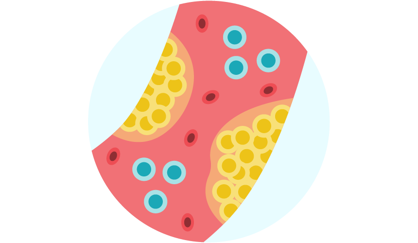 what-is-familial-hypercholesterolemia-color